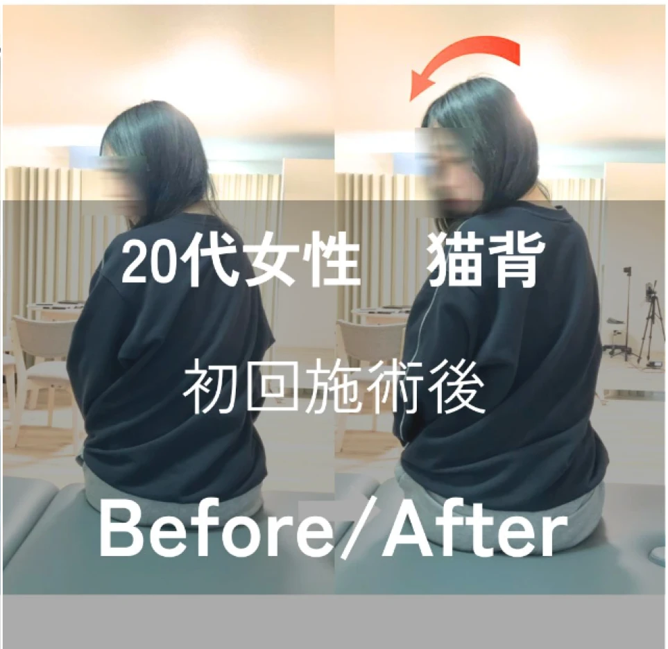 施術画像１